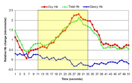 fNIRS對(duì)成人運(yùn)動(dòng)任務(wù)行為中大腦皮層的評(píng)估