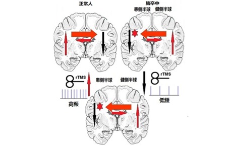 2019冠狀病毒病與相關(guān)神經(jīng)精神疾病的神經(jīng)調(diào)控康復(fù)