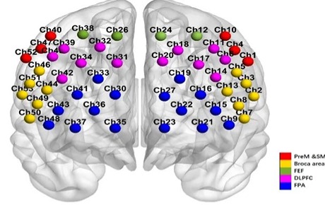 不同狀態(tài)fNIRS揭示帕金森患者膀胱過度活動(dòng)癥狀的前額葉皮層激活和網(wǎng)絡(luò)模式